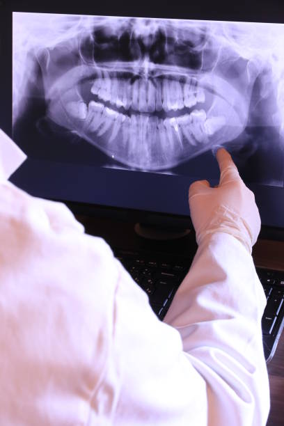 Best After-Hours Emergency Dentist in Glen Ellen, CA